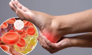 مشکلات کلسترول بالا