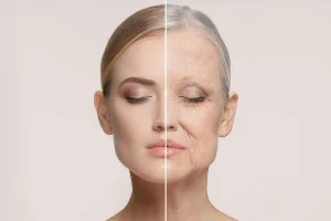 نقش تغذیه در پیشگیری از چین و چروک زودرس