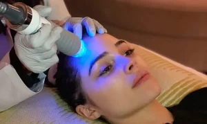 لیزرهای پیشرفته جوانسازی پوست و کاهش چین و چروک