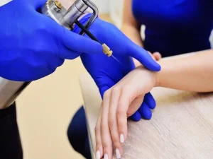 دستگاههای RF (فرکانس رادیویی) و تأثیر آنها بر سفت شدن پوست