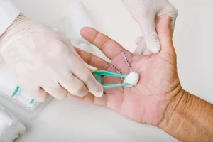 نکات طلایی برای تسریع ترمیم زخم