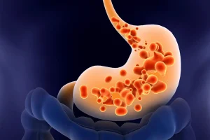 مهم ‌ترین دلایل رفلاکس معده