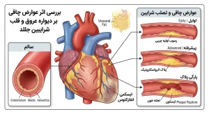 بررسی اثر عوارض چاقی بر دیواره عروق و قلب
