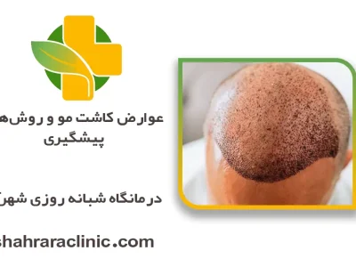 عوارض کاشت مو و روش‌های پیشگیری